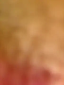 Enferma Sexual05 online show from March 2025 10:19:01 AM